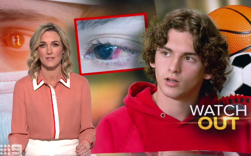 screen grab from channel 9 news story on sports related eye injuries