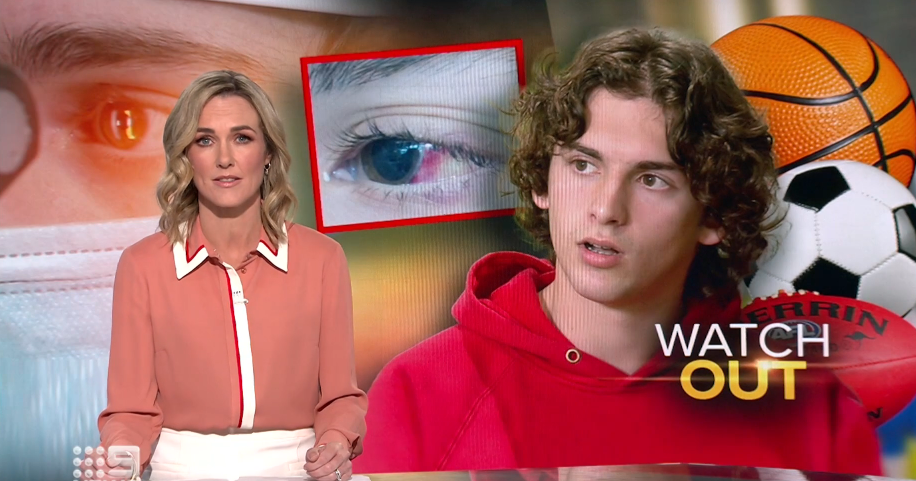 screen grab from channel 9 news story on sports related eye injuries