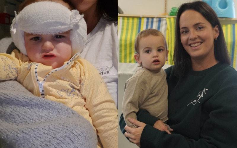 Photo of Knox after surgery, next to photo of Knox and mum at nearly 2 years old