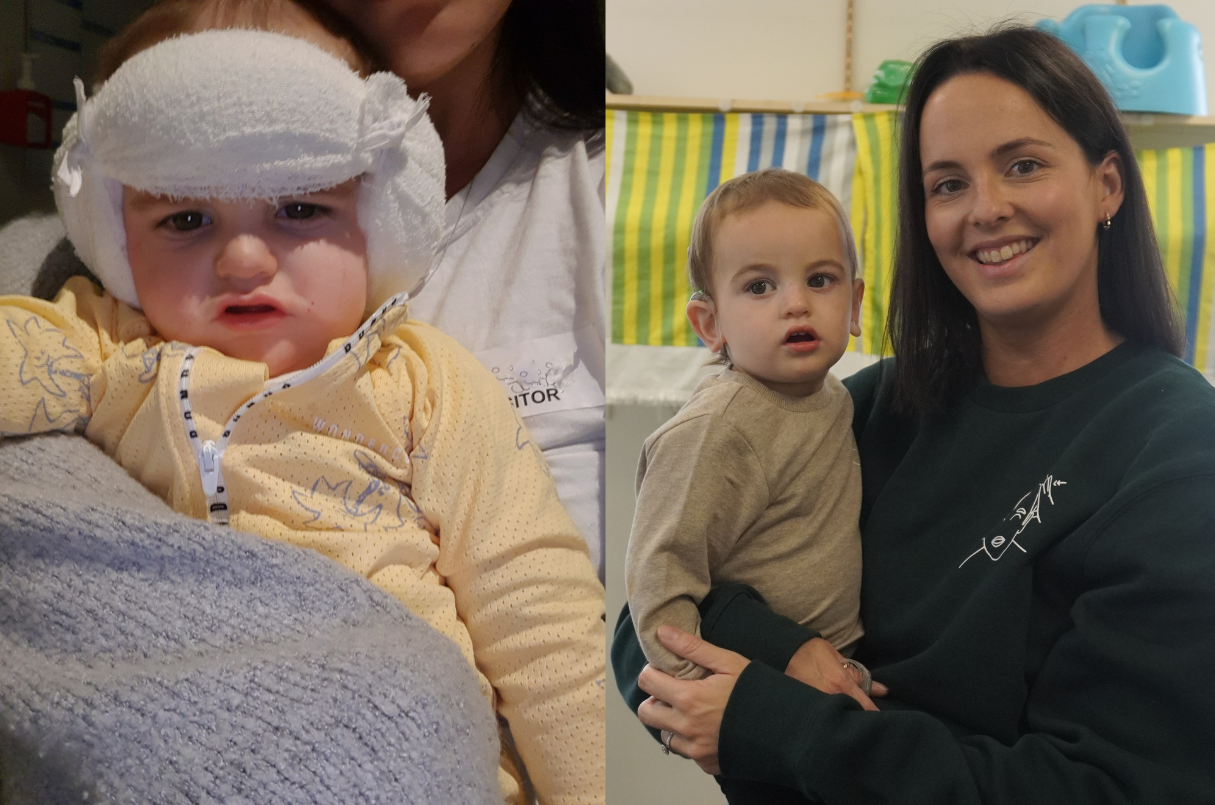 Photo of Knox after surgery, next to photo of Knox and mum at nearly 2 years old