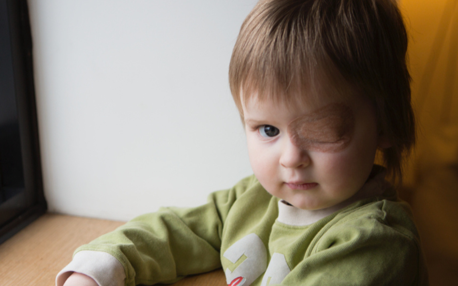 A young boy wears an eye patch