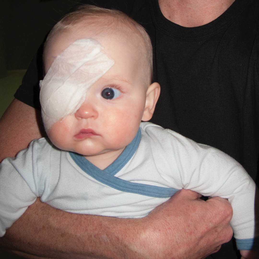 A baby wears a medial eye patch