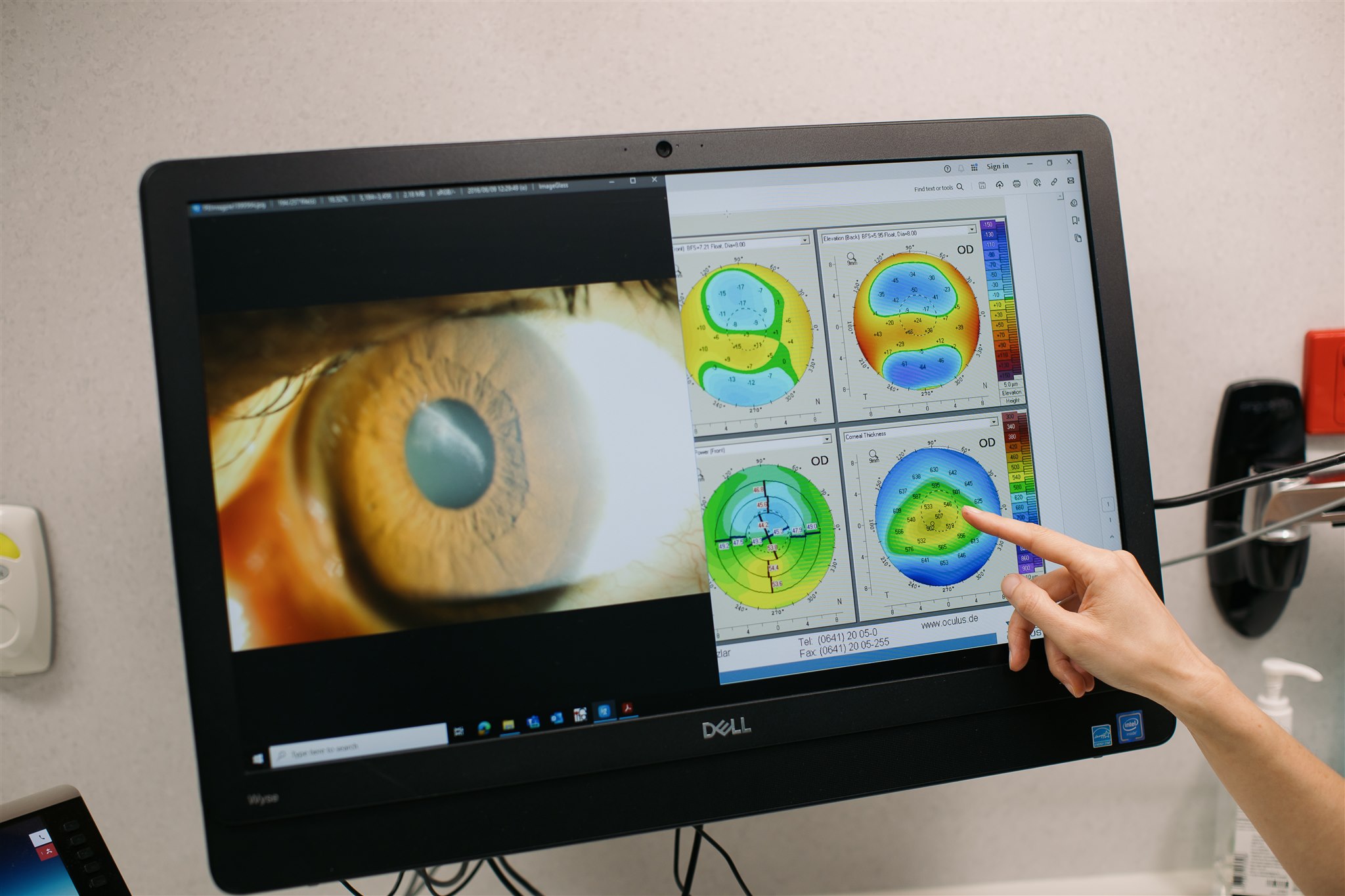 A photo of an eye next to some scans on a computer screen, a hand is pointing at it