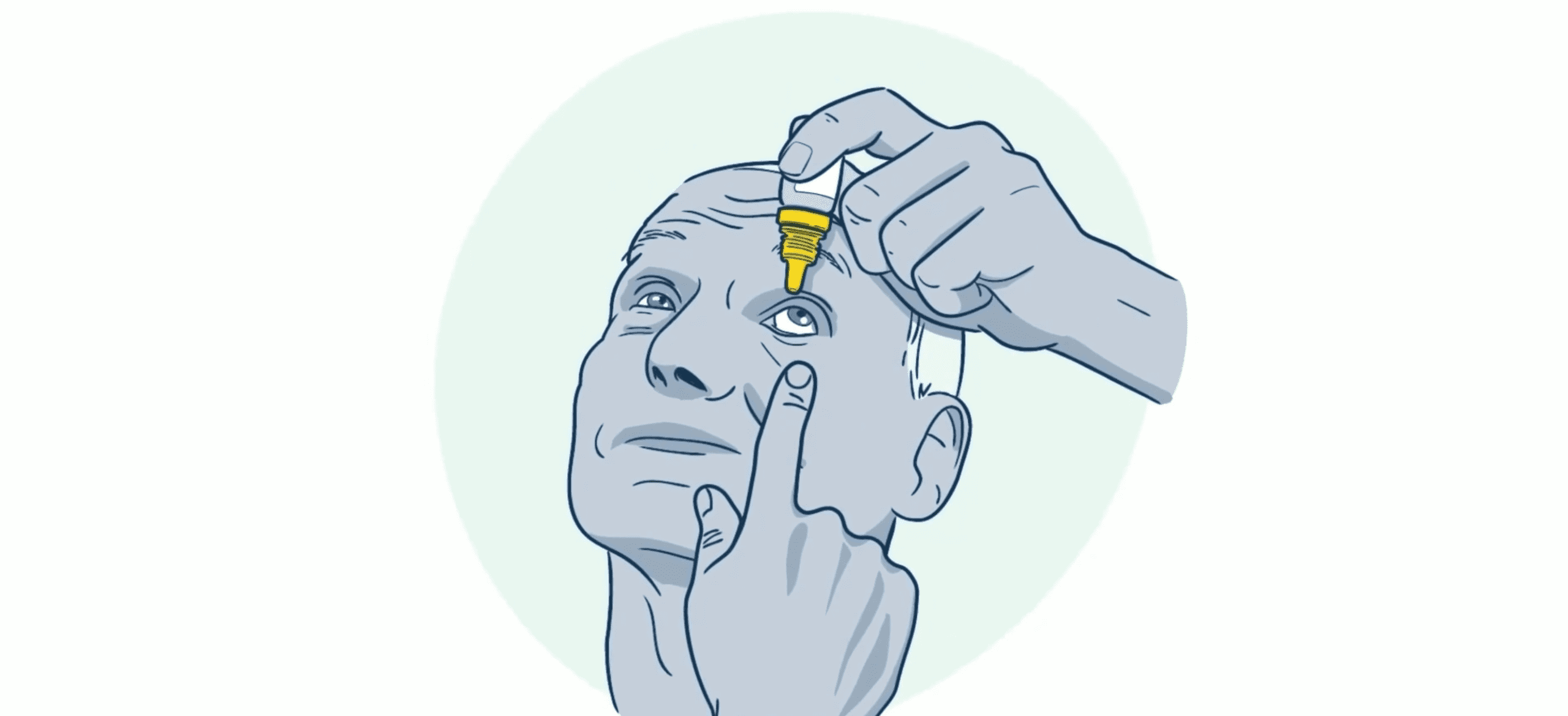 A cartoon graphic of a man putting eye drops in his eye.